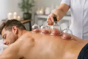 Werkt cupping behandeling bij spierherstel?
